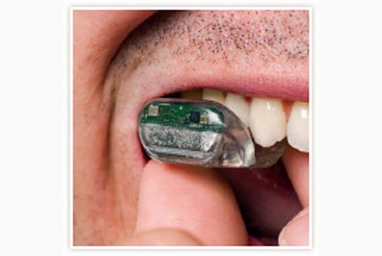 Nieuw type gehoorapparaat brengt geluid over via gebit